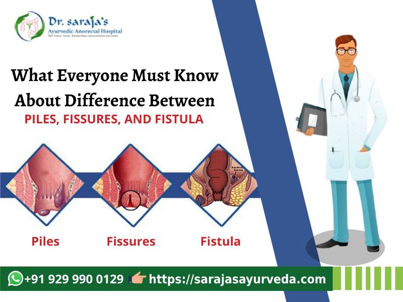 Difference Between Piles, Fissures, and Fistula