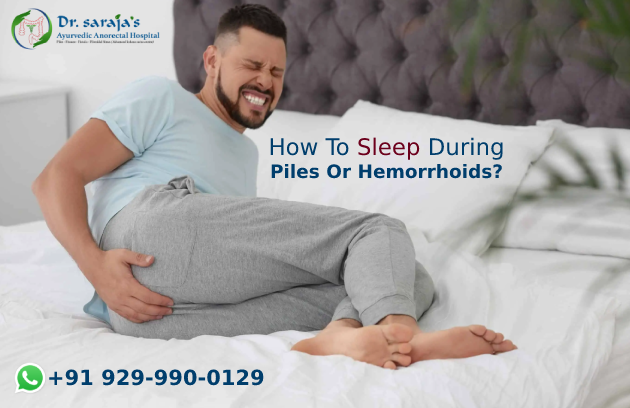 How To Sleep During Piles Or Hemorrhoids