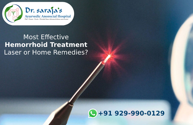 Most Effective Hemorrhoid Treatment Laser or Home Remedies