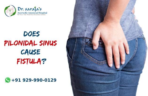 Does Pilonidal Sinus Cause Fistula