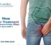 How Laser Treatment Helps Hemorrhoids (Piles) in Ayurvedic