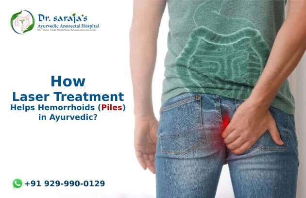 How Laser Treatment Helps Hemorrhoids (Piles) in Ayurvedic