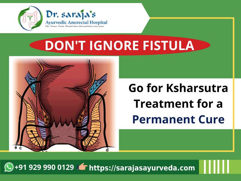 Don't Ignore Fistula. Go for Ksharsutra Treatment for a Permanent Cure