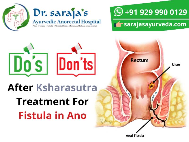 Dos and Don’ts After Ksharasutra Treatment For Fistula in Ano
