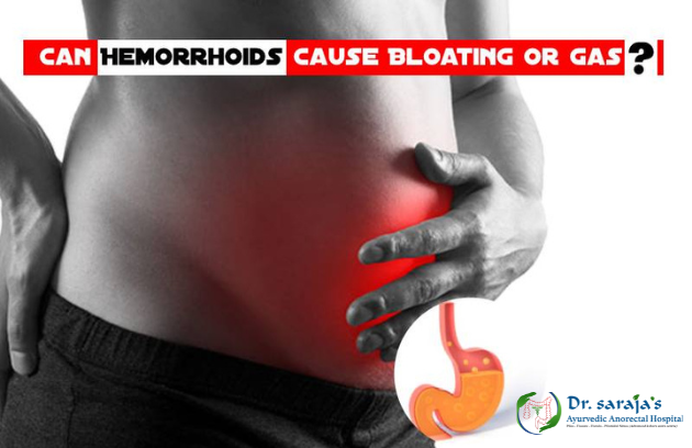 Can Hemorrhoids Cause Bloating or Gas