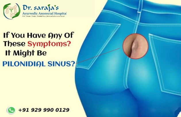 If You Have Any Of These Symptoms Pilonidal sinus