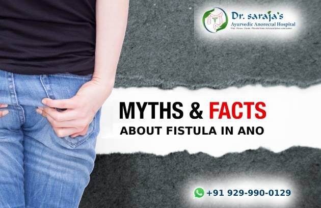 Myths and Facts about Fistula in Ano