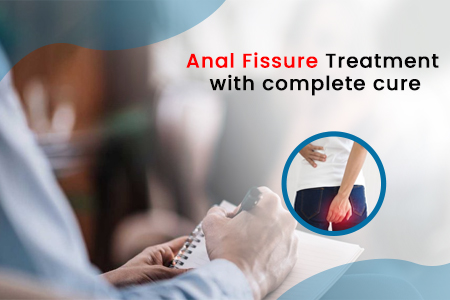 Anal Fissure Treatment with complete cure