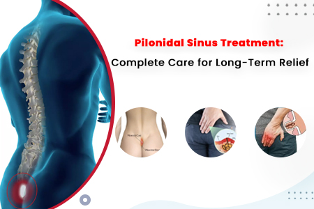 Pilonidal Sinus Treatment