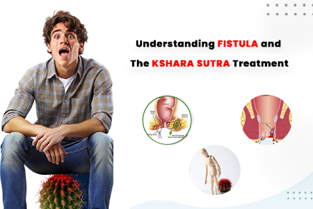 Kshara Sutra Treatment