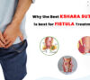 fistula treatment