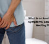 Anal Fissure Treatments