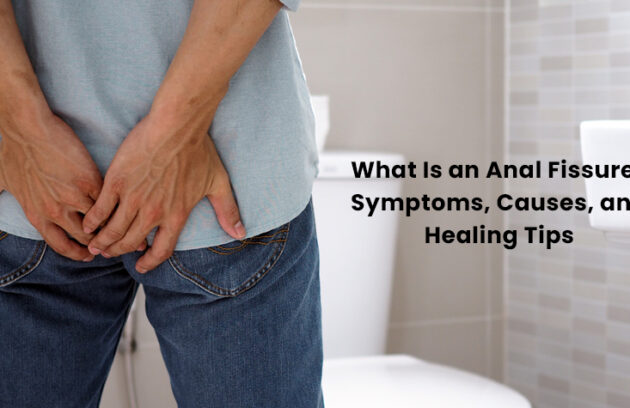 Anal Fissure Treatments